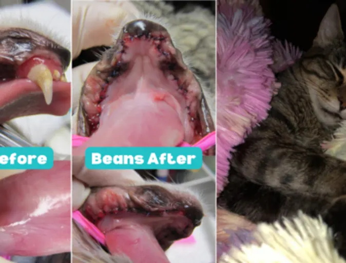 Bean's before and after dental images